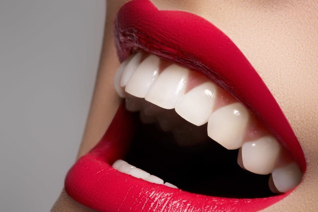 Woman smiling in red lipstick with white teeth