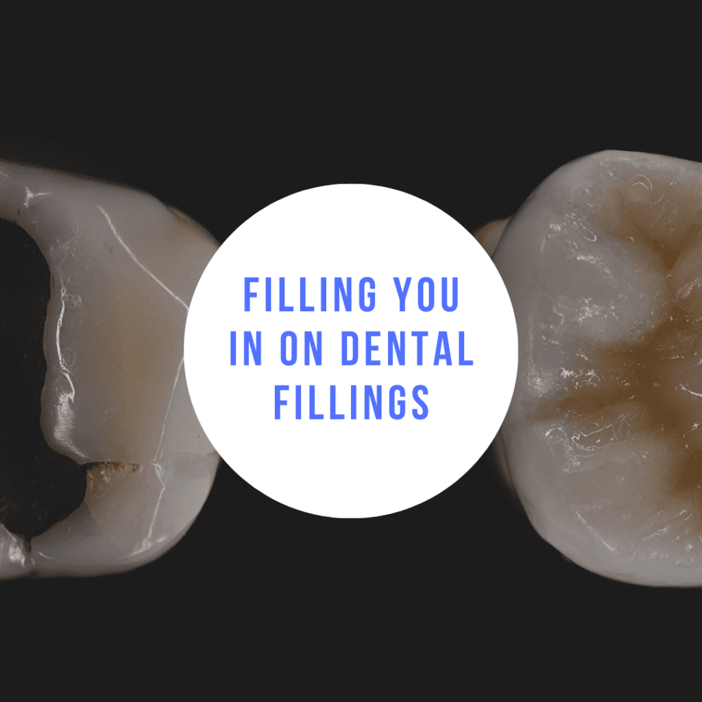 Filling You In On Dental Fillings